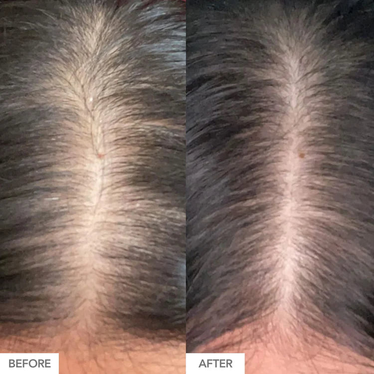 Hairtamin- Advanced Formula