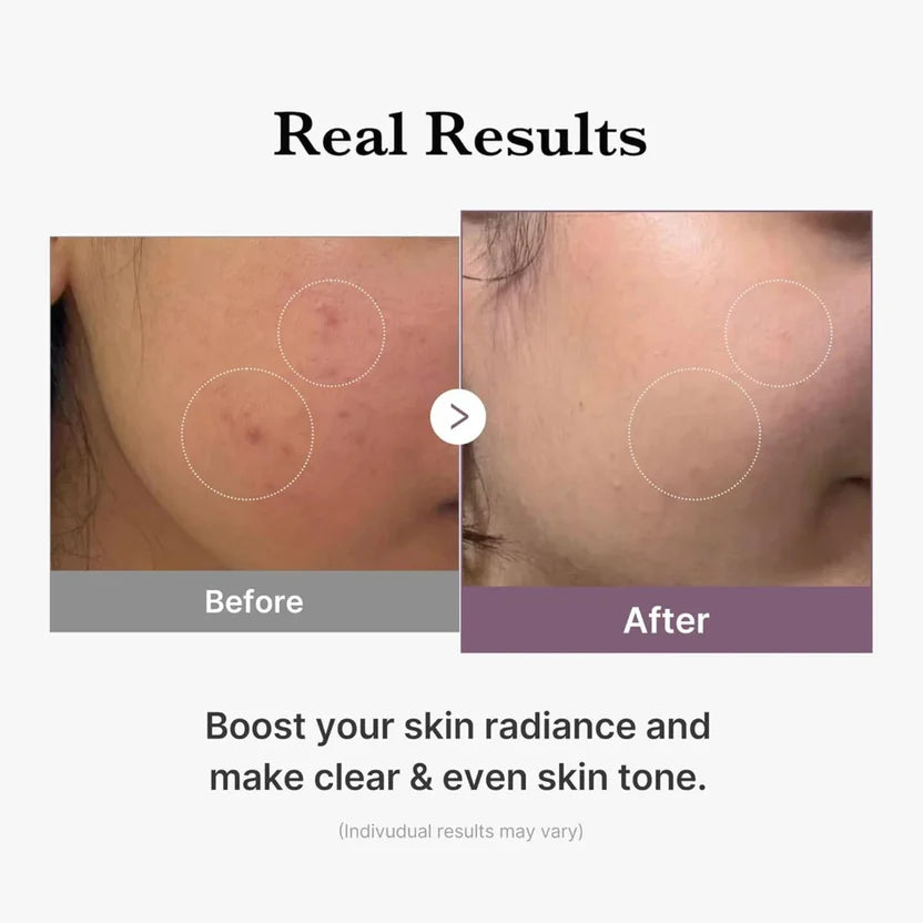 Medicube Age-R Glutathione Glow Toner 140 ml