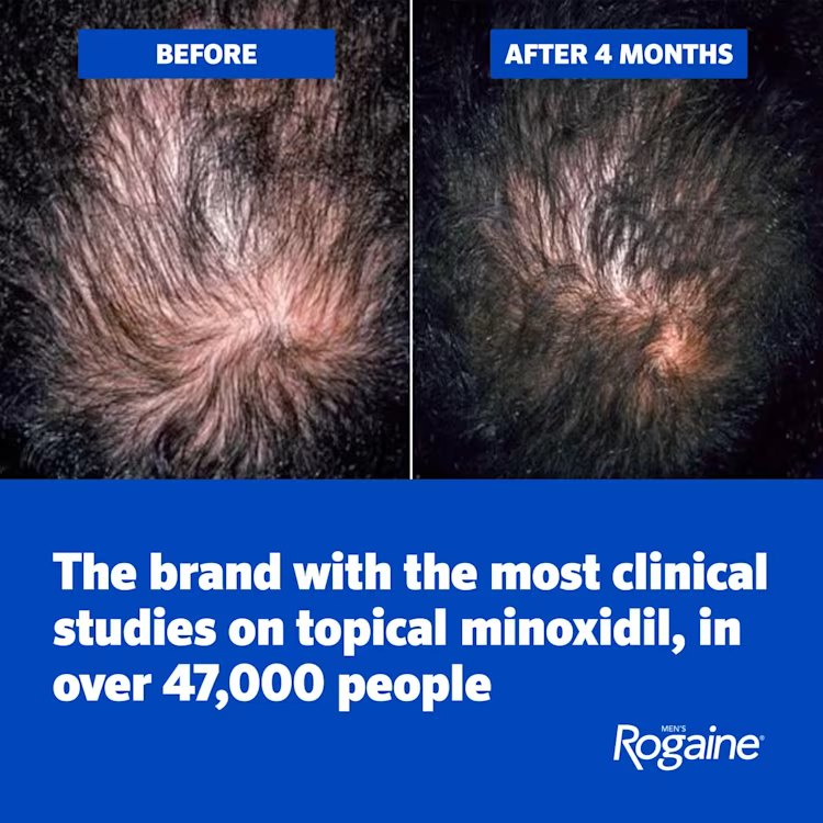 Men's ROGAINE® 5% Minoxidil Unscented Foam - 3-Month Supply