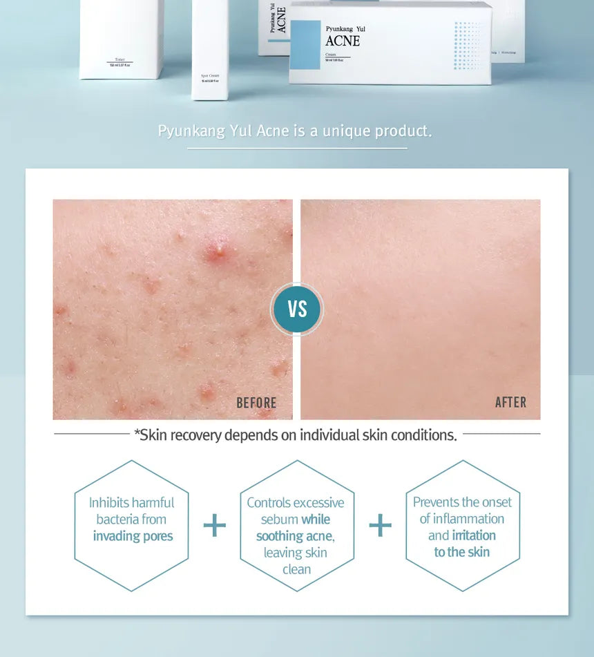 Pyunkang Yul - Acne Cream 50ml