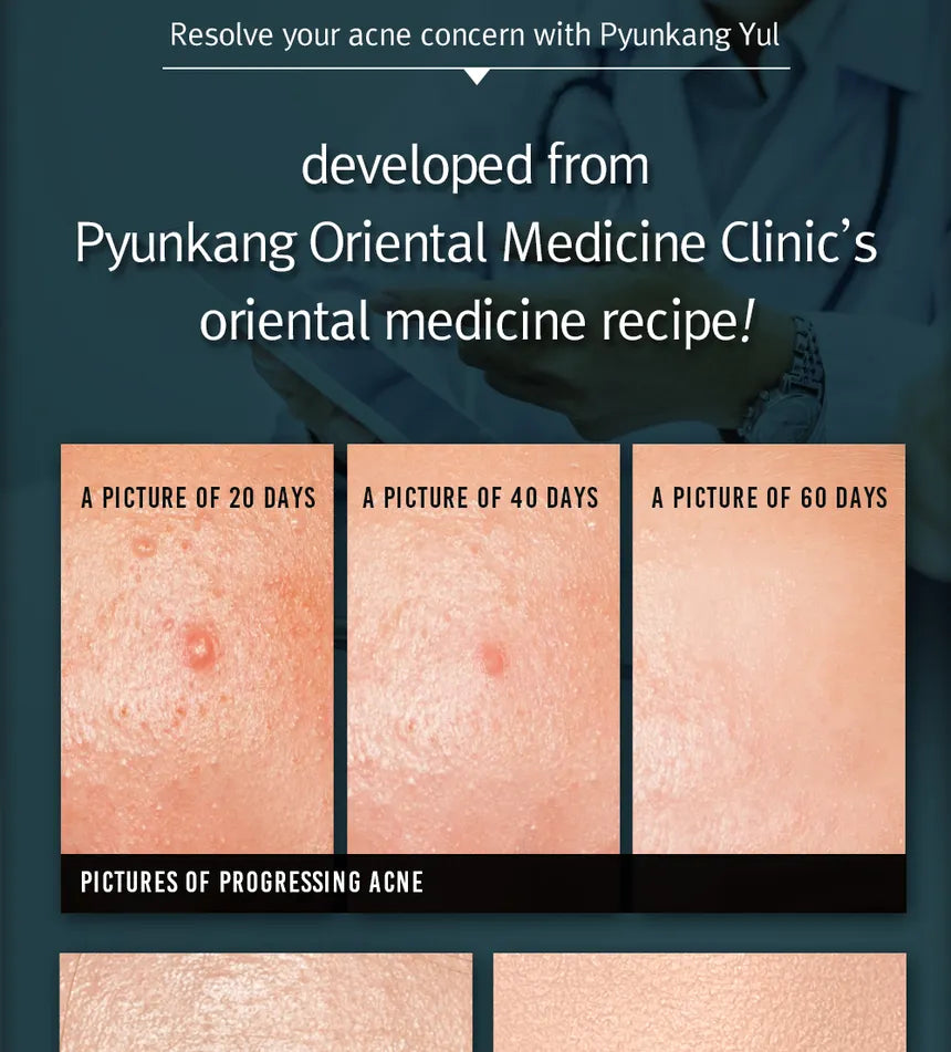 Pyunkang Yul - Acne Cream 50ml