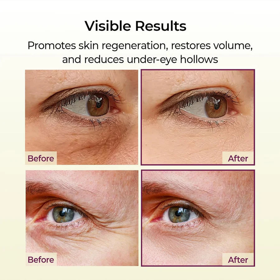 Dr.Melaxin Cemenrete Calcium Volume Multi Balm 9g