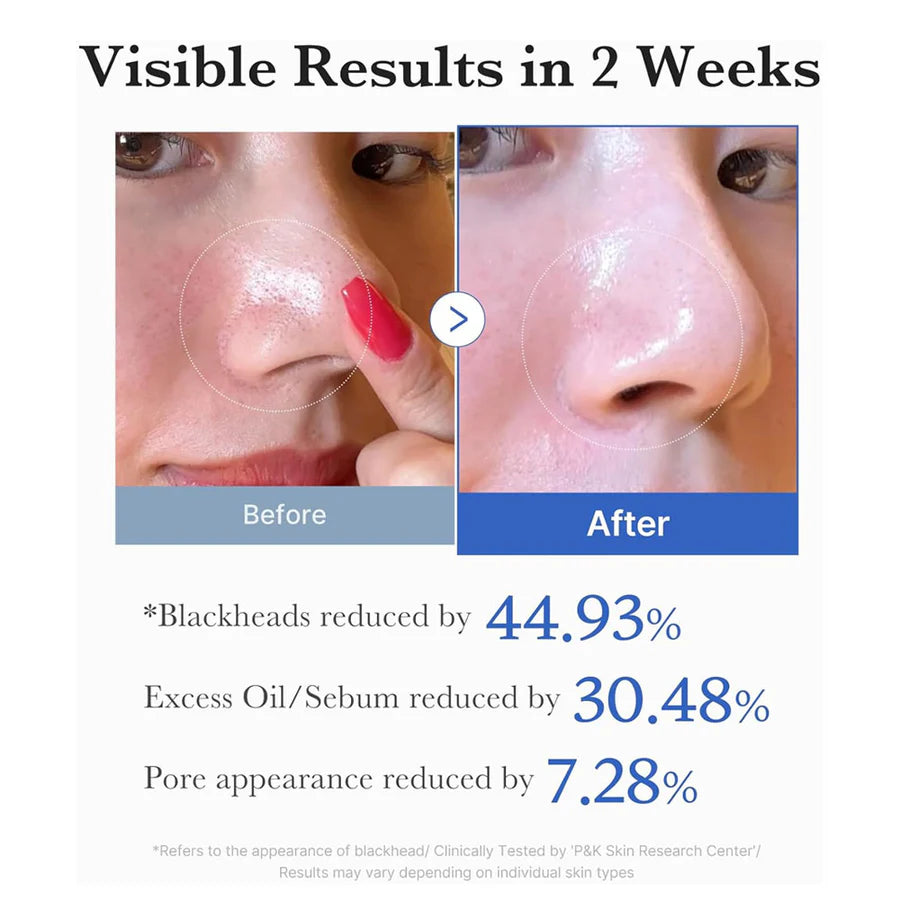 Medicube – Zero Pore Pad 2.0 (70 Pads) 155g